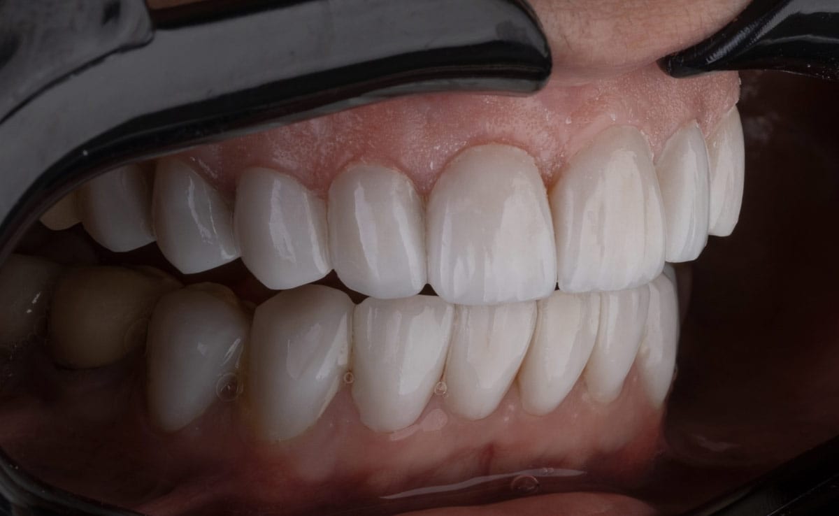 This Japanese Company Is Working On World’s First Drug To Grow New Teeth
