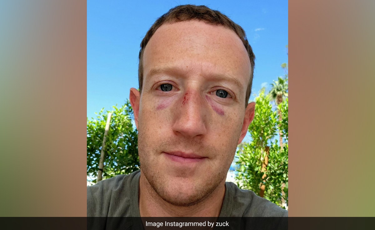 Mark Zuckerberg Get 2 Black Eyes After Jiu-Jitsu Training, Shares Selfie