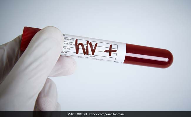 HIV Patients Cured Through Risky Transplant Are Now “Living Proof” Of Hope