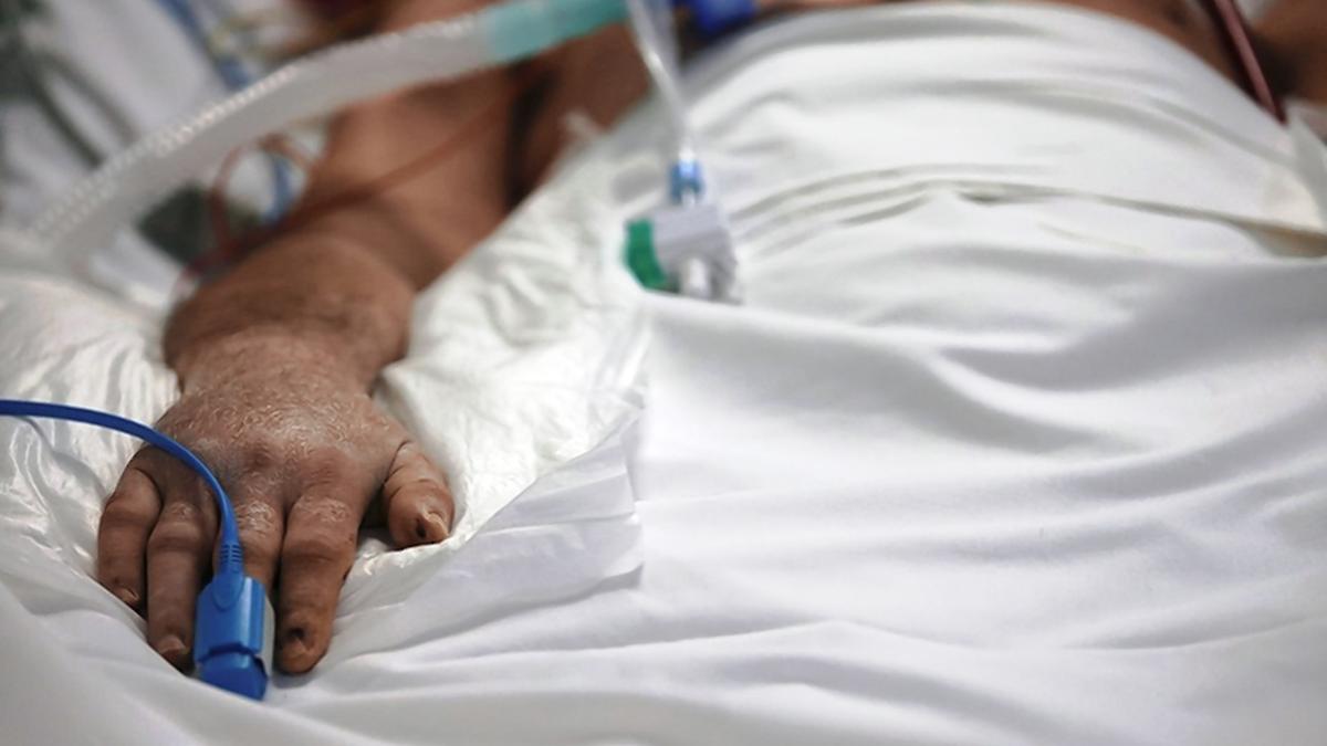 Pulse oximeters: Does skin colour affect SpO2 measurements?