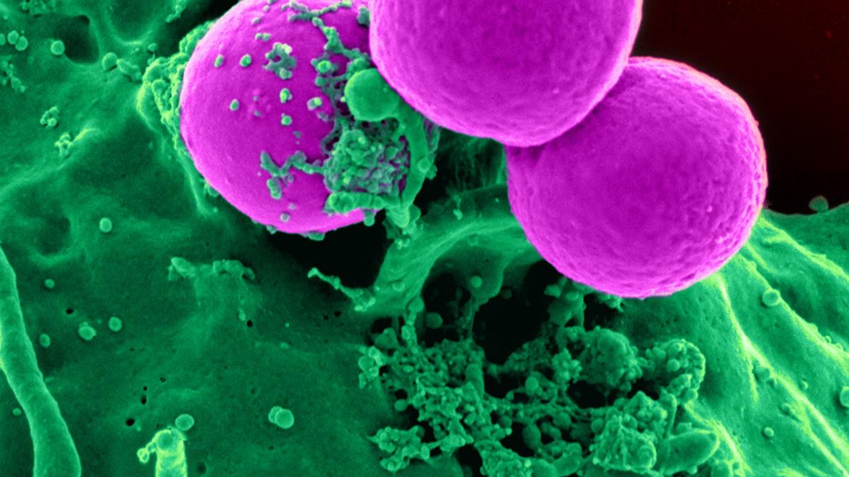 Vancomycin may not be able to treat MRSA infections for long
