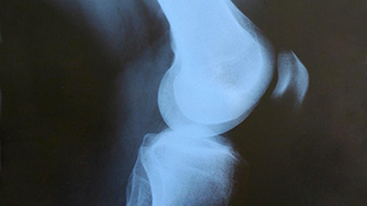 Sci five | The Hindu Science Quiz: on bones