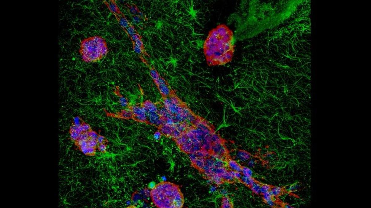 Indian Institute of Science study reveals how cancer cells adapt while moving across tissues