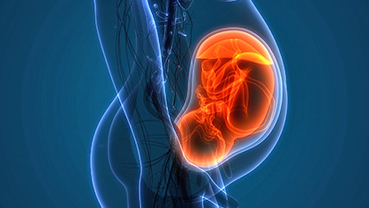 Fetus in fetu – The Hindu