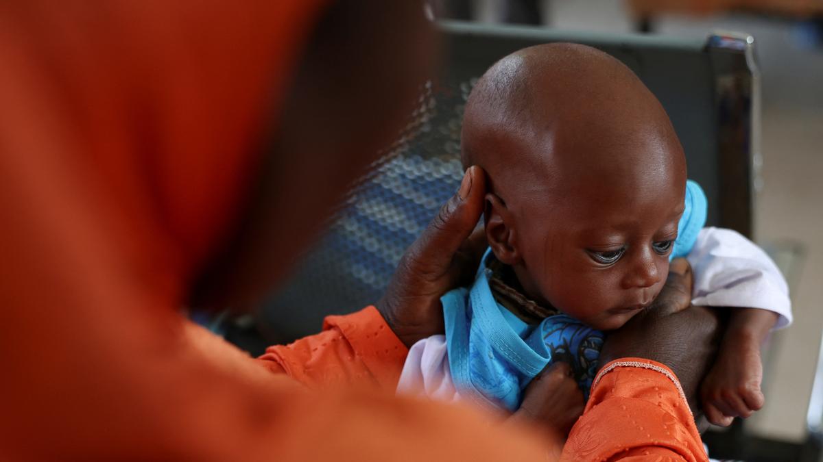 Conflict, poverty, climate change fuel Nigeria’s worsening malnutrition crisis