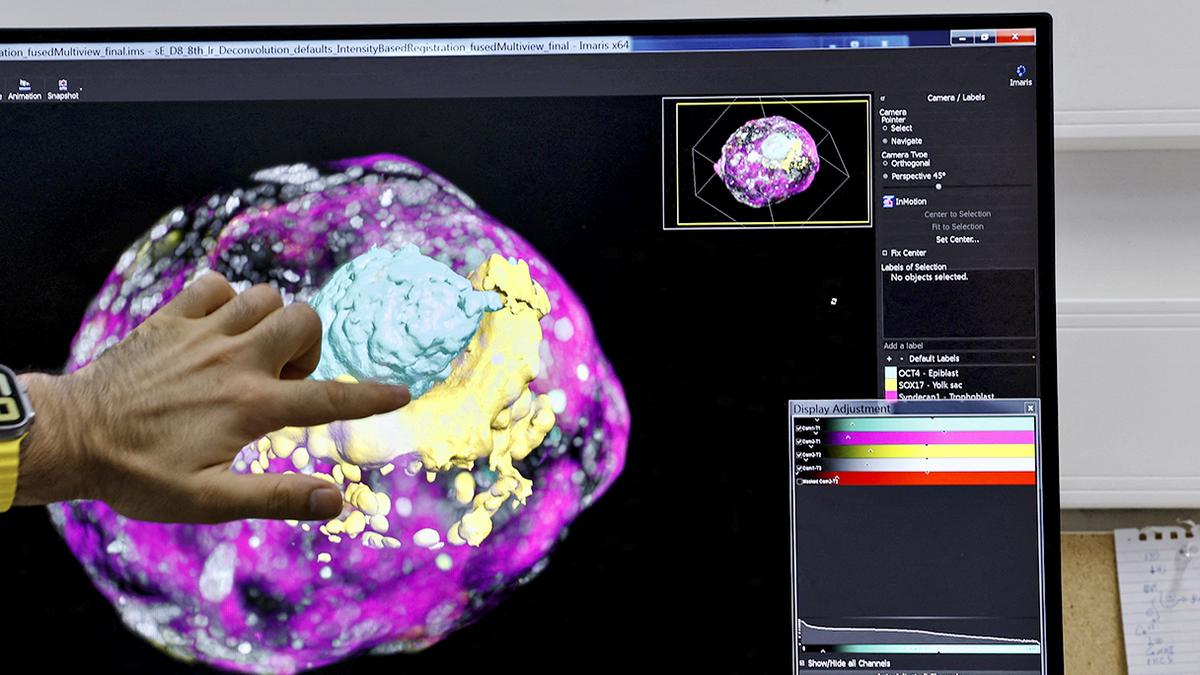 Science for all: First real-time video of how an embryo implants itself produced