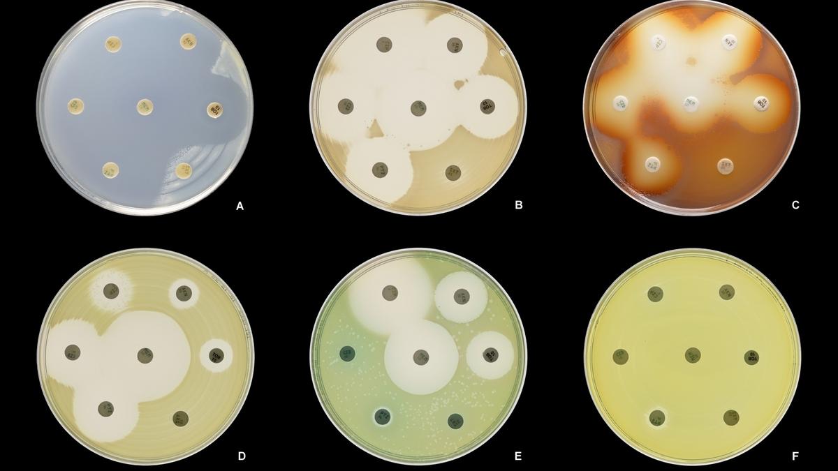 A bistable gene in a deadly bacterium offers a clue to beating it