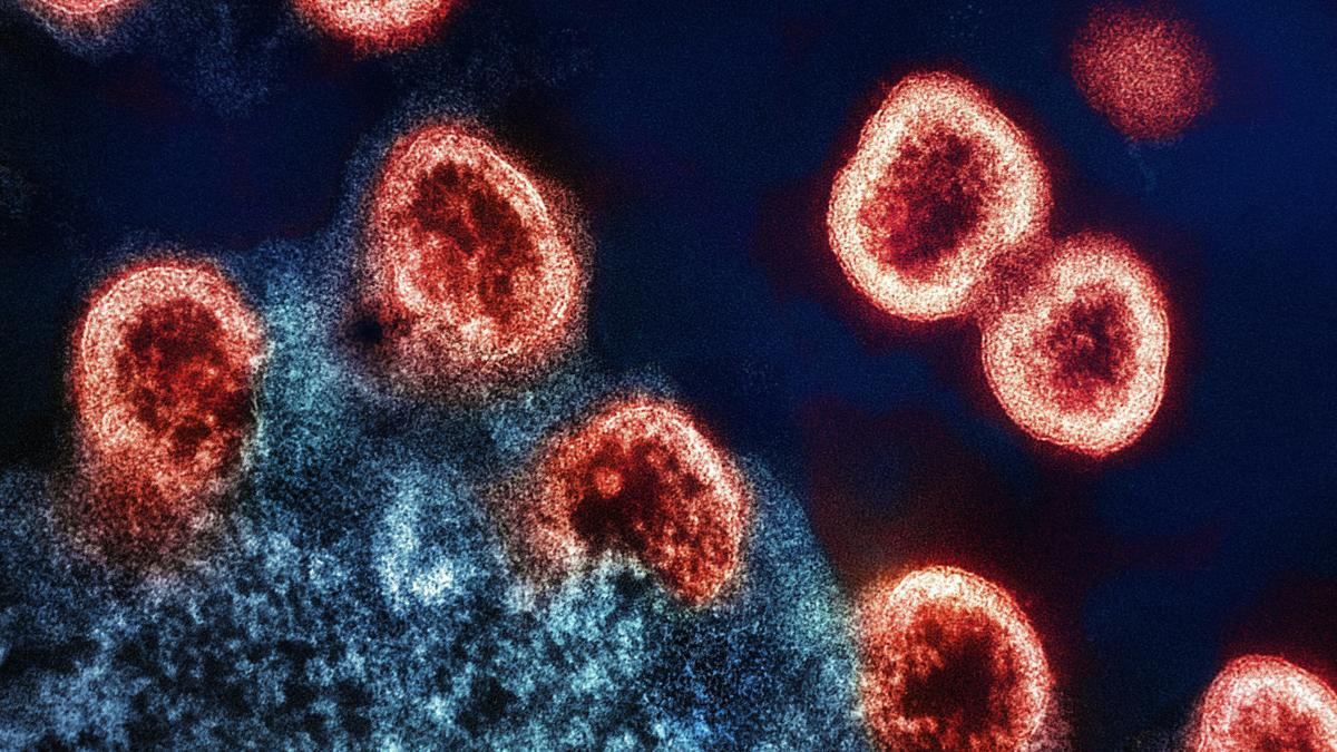 HIV strains in India resist some top broadly neutralising antibodies