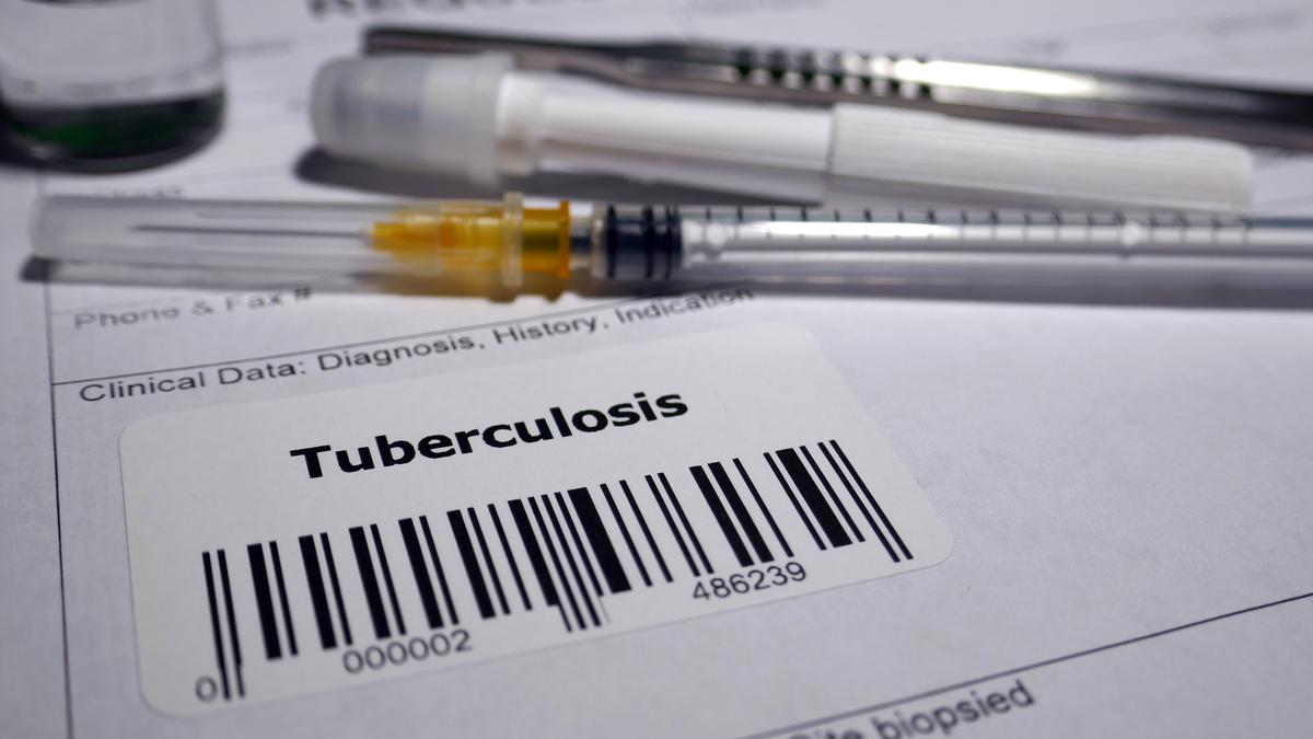 Global TB funding lags, reaching only a quarter of WHO targets