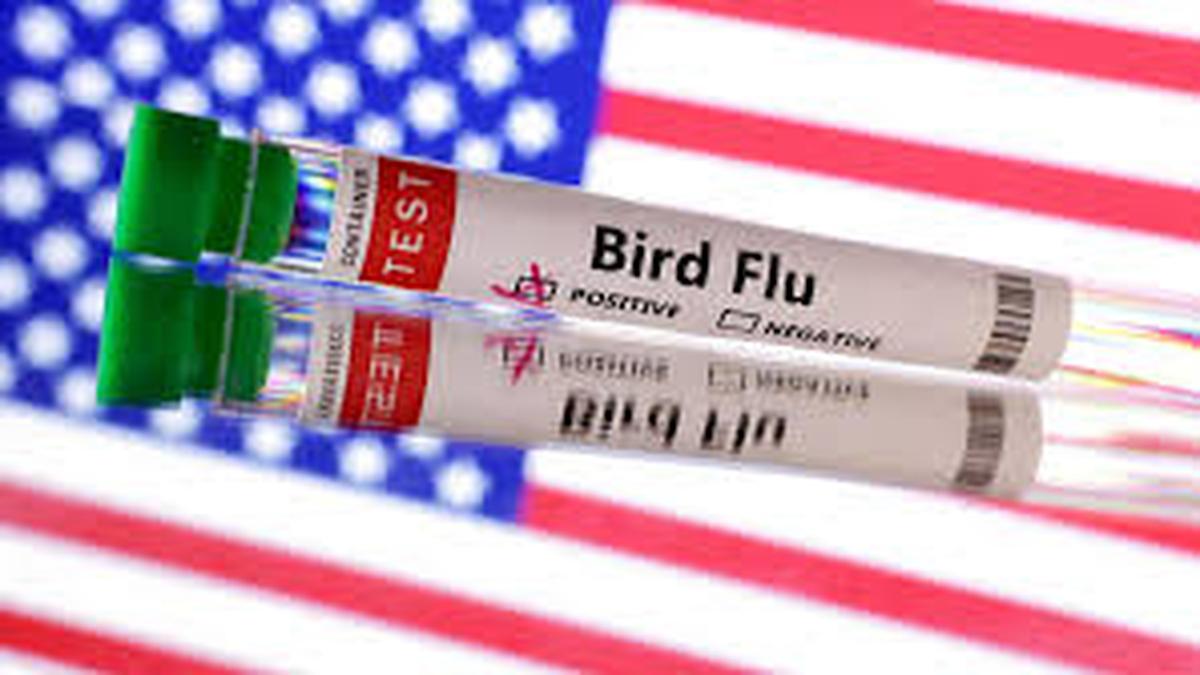 U.S. resident infected with H5N5 — a different type of bird flu