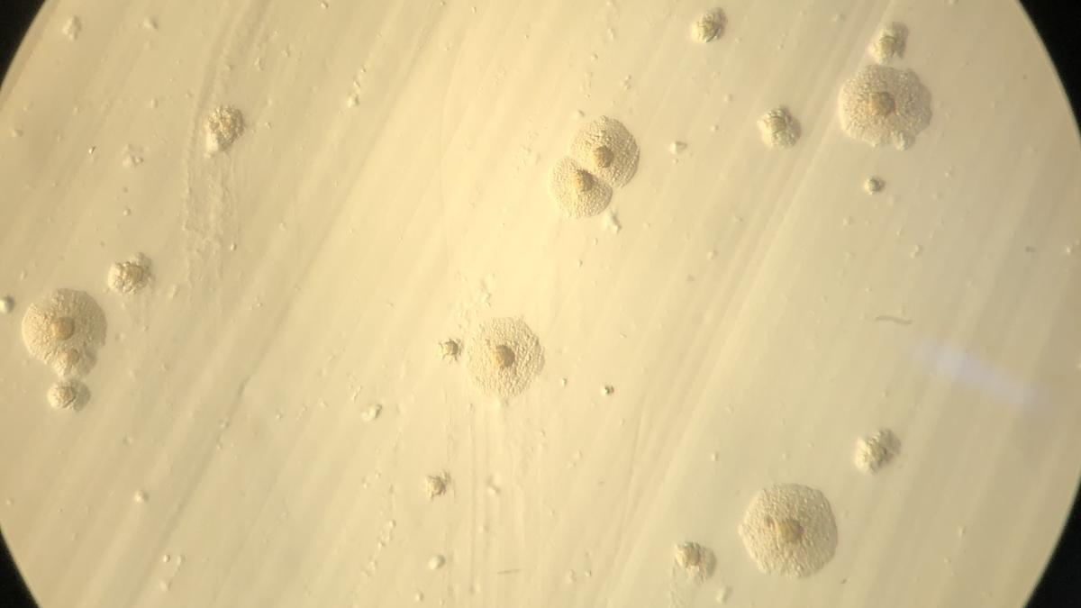 Unusual genetic code in Antarctic microbes yields rare amino acid