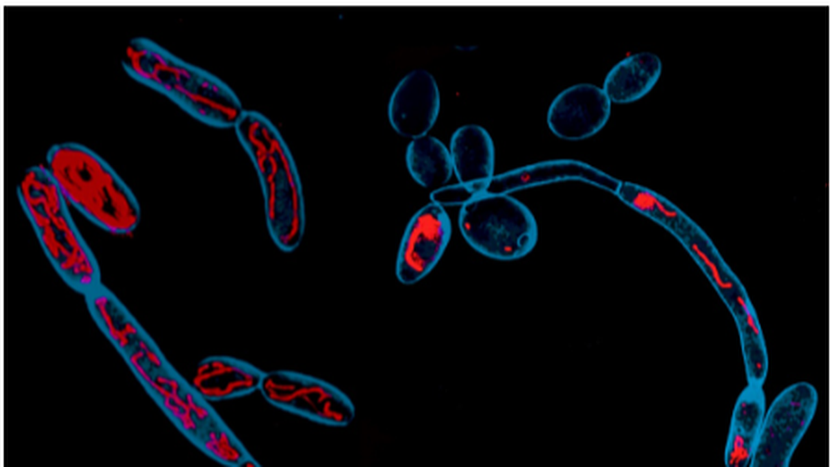 CCMB scientists identify metabolism as new target for antifungal therapies