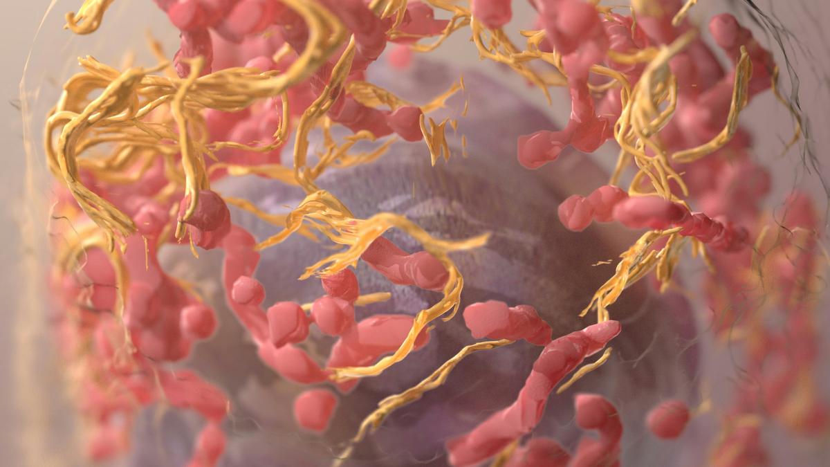 Cholesterol makes cells’ nuclei squishy, helping melanoma spread