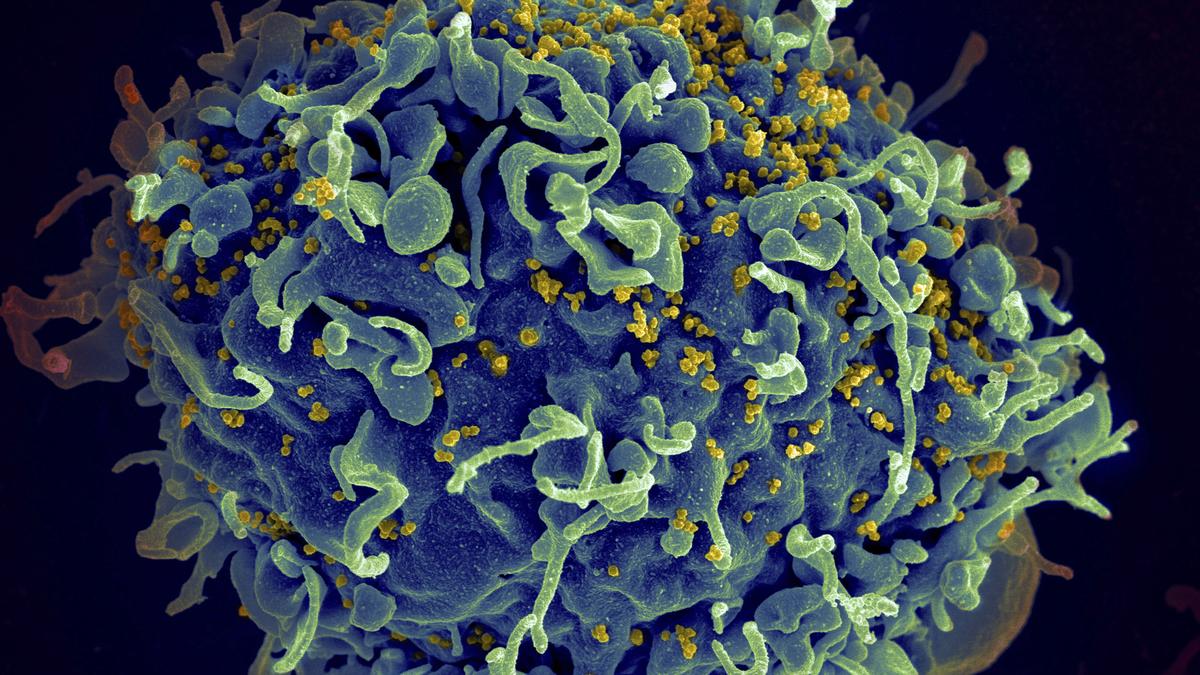 Small study hints that revving up immune cells might help fight HIV