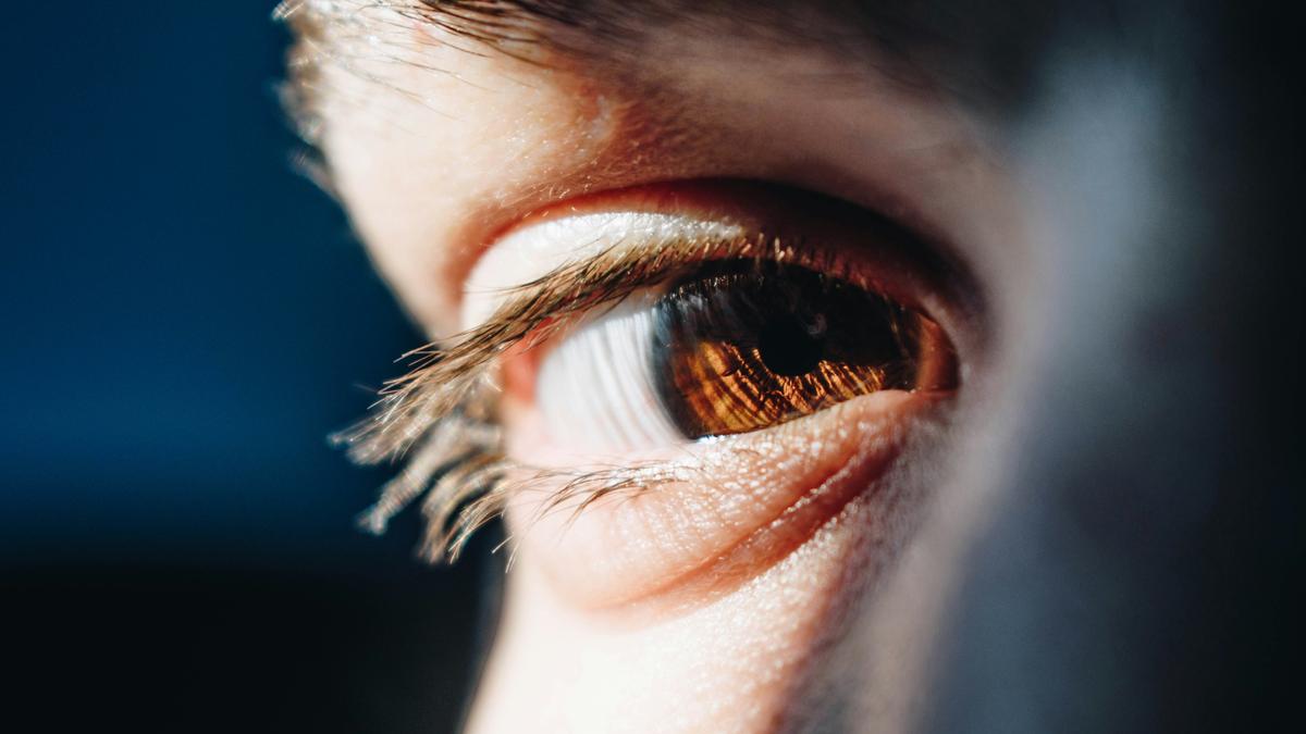 Why are the whites of human eyes white?